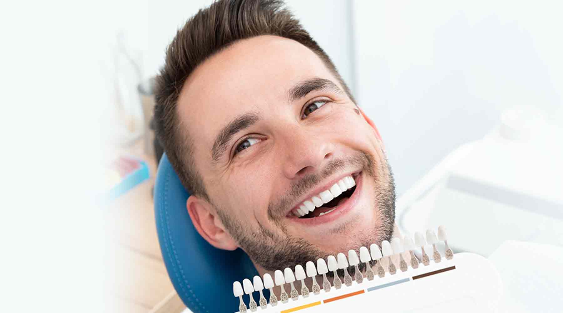 Dental-Veneers